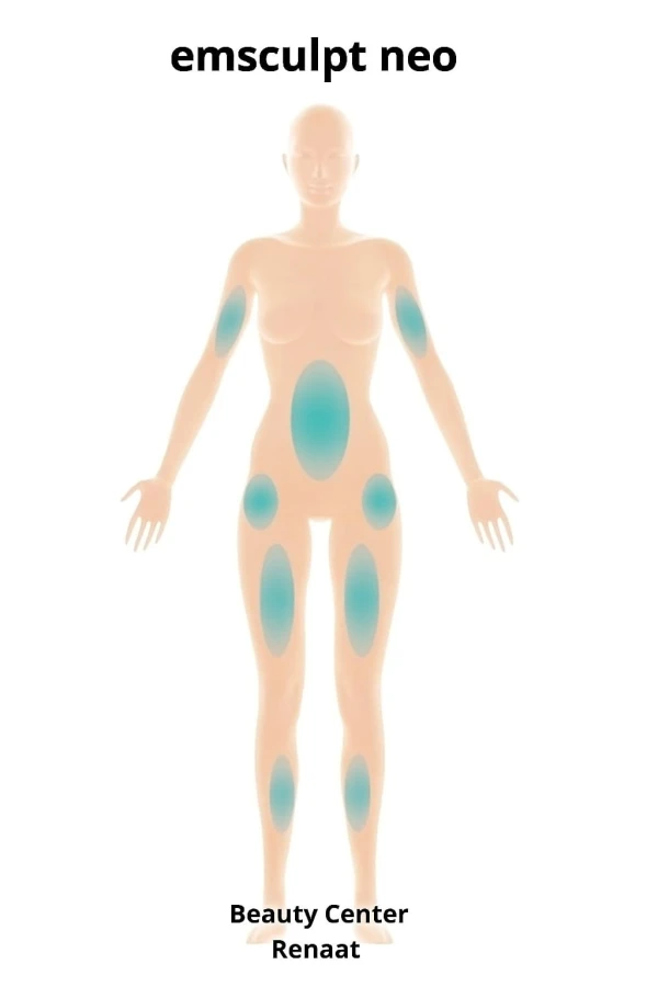 Afslanken EMsculpt NEO